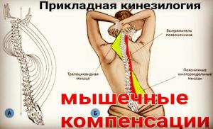 Фотография Здоровая спина 2