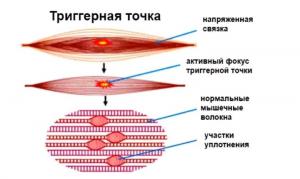 Фотография Здоровая спина 5