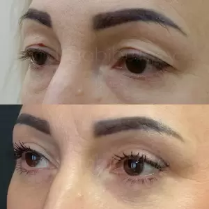 Фотография Алмед 4