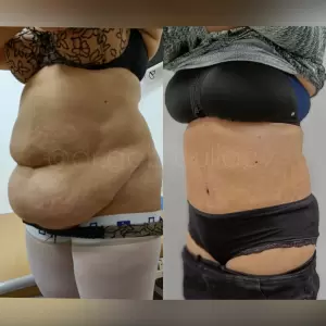 Фотография Алмед 5